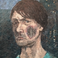 Человек с неизвестным заболеванием на лице