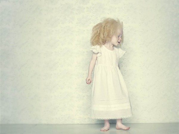 albinos_10.jpg