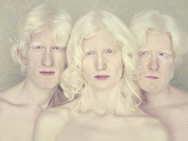 albinos_11.jpg