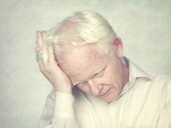 albinos_13.jpg