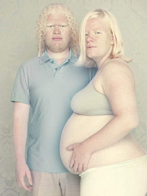 albinos_14.jpg