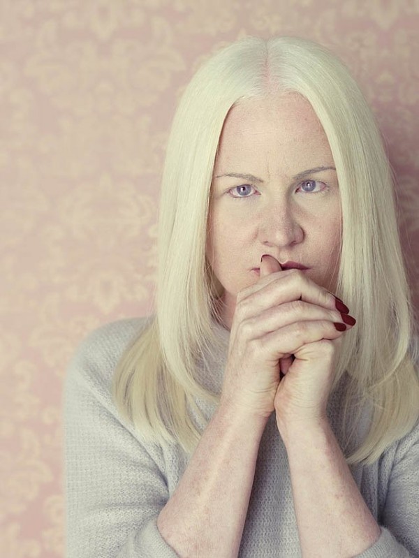 albinos_15.jpg