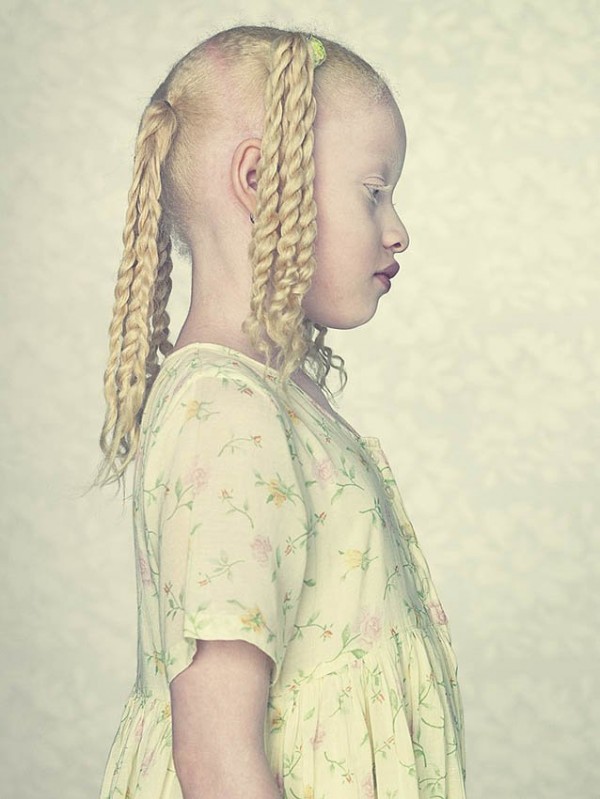 albinos_18.jpg
