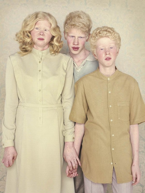 albinos_19.jpg