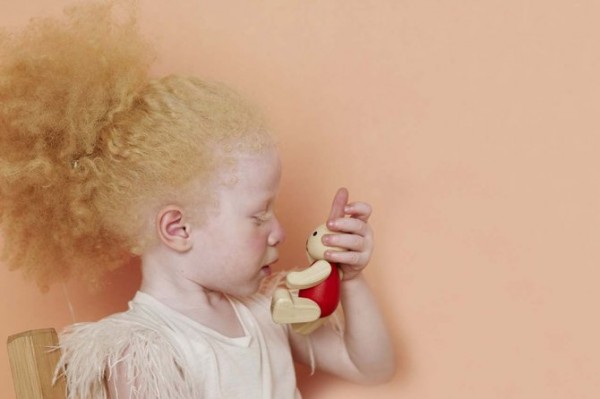 albinos_2.jpg