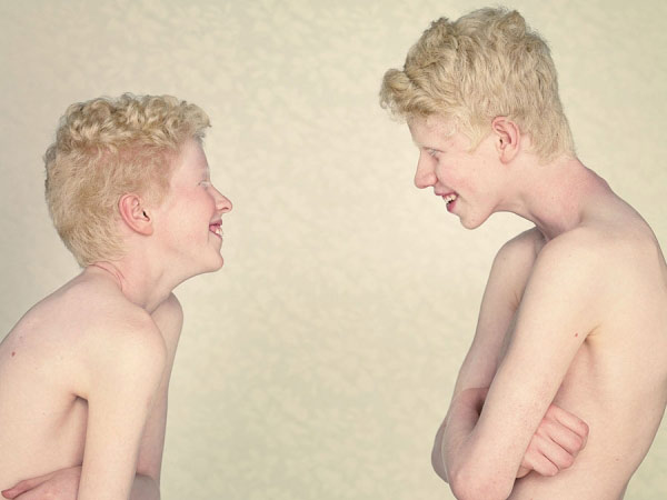 albinos_20.jpg