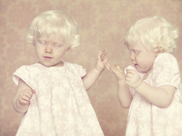 albinos_6.jpg