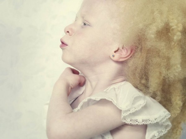 albinos_9.jpg